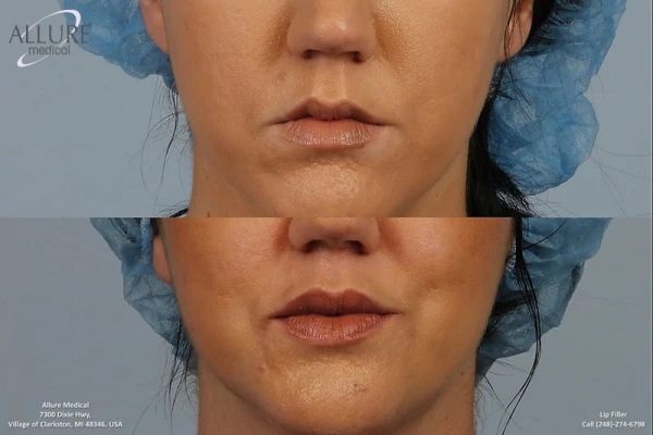 allure-medical-4.jpg