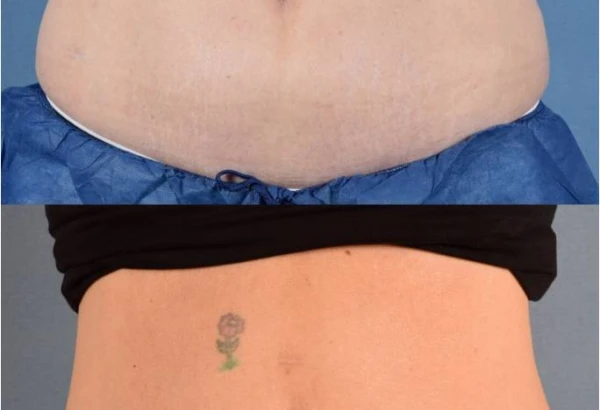 rejuvenis-facial-cosmetic-surgery-and-medical-spa-4.jpg