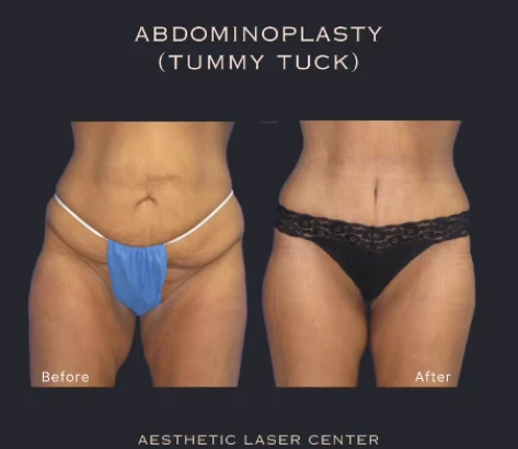 aesthetic-laser-center-4.png