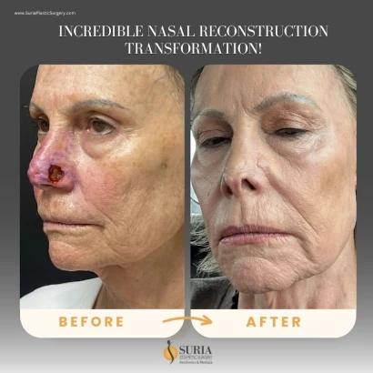 suria-cosmetic-surgery-medspa-4.jpg