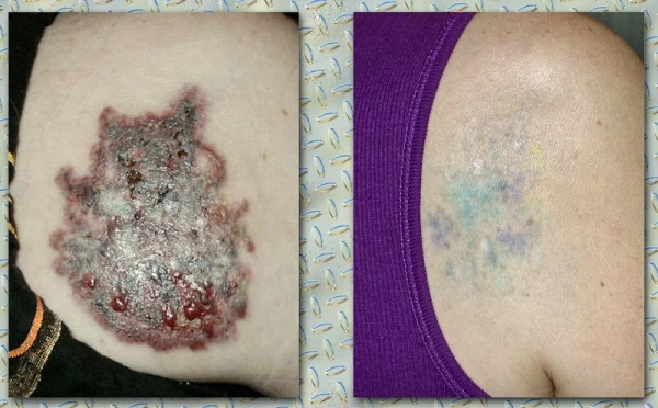 dr-michael-gray-the-michigan-cosmetic-surgery-center-and-skin-deep-spa-2.jpg