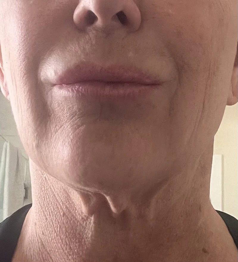 Desert Plastic Surgery Center, Rancho Mirage, California, 72301