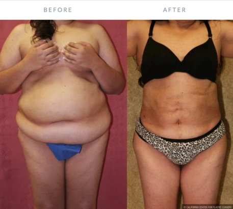 dr-sean-younai-plastic-surgery-2.png
