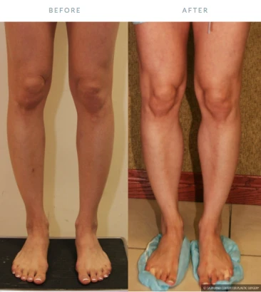 dr-sean-younai-plastic-surgery-3.png