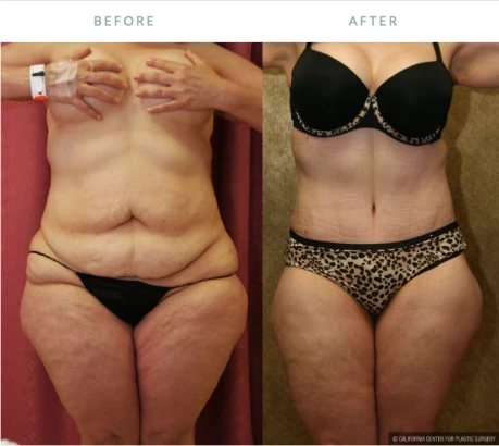 dr-sean-younai-plastic-surgery-4.png