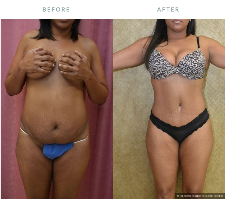 Dr. Sean Younai Plastic Surgery