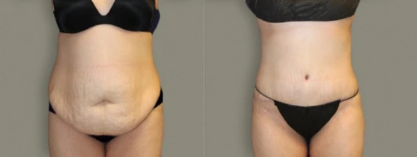athenix-advanced-plastic-surgery-aesthetic-centers-1.jpg