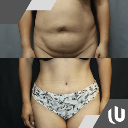 phuong-m-pham-md-united-plastic-surgery-2.png