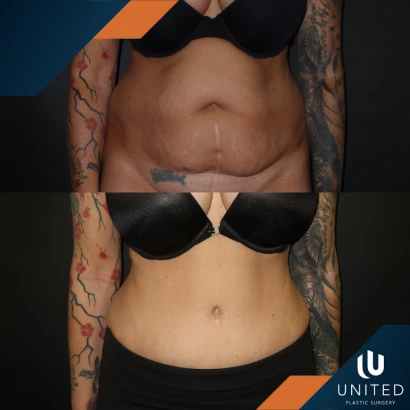 phuong-m-pham-md-united-plastic-surgery-4.png