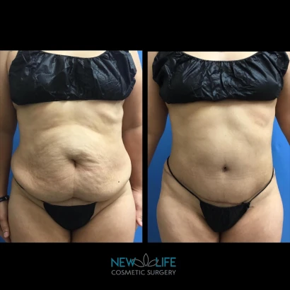 new-life-cosmetic-surgery-and-wellness-center-4.png