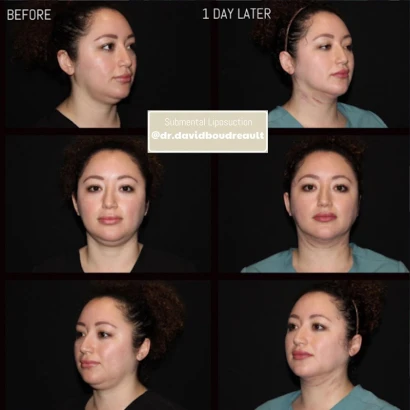 illuminate-plastic-surgery-palo-alto-4.jpg