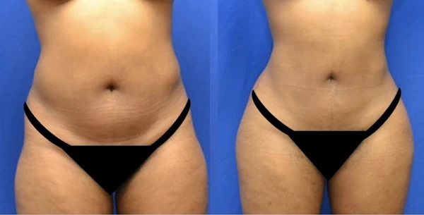 georgia-plastic-reconstructive-surgery-3.jpg