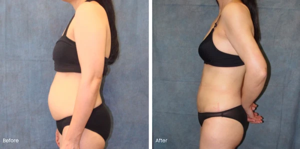 belmont-plastic-surgery-3.png