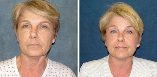 belmont-plastic-surgery-4.png