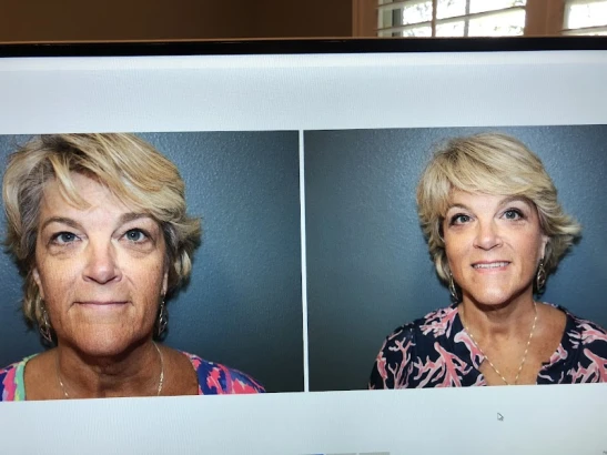 Bayside Center for Plastic Surgery Tampa in Lutz, Florida ...